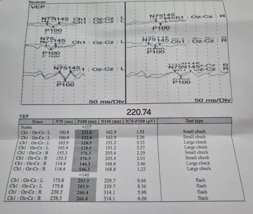 2ab2de21ecd907a86ba89be74683706da81ca754847eff9802741bf5e23f0715274e0a39cc3d4f93c9085872b4ad